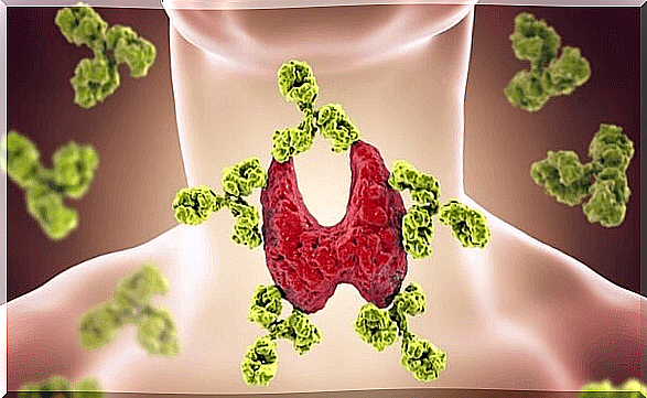 Thyroid disorder