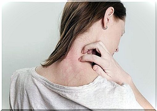 Woman with itchy body